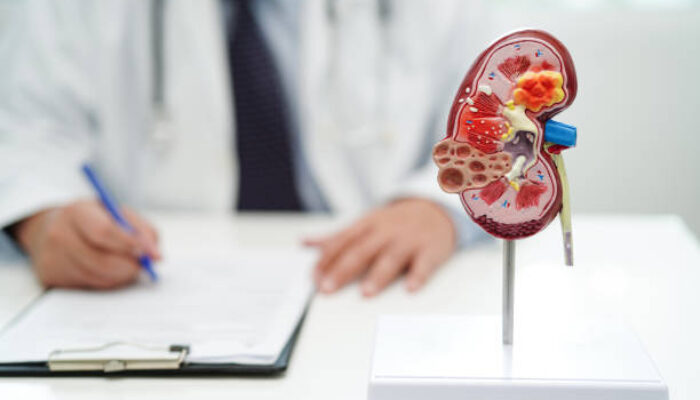 Tekanan Darah Tinggi Dapat Rusak Ginjal Tanpa Disadari