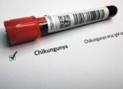 Kasus Suspek Chikungunya 2025 Melonjak, Kemenkes Waspada