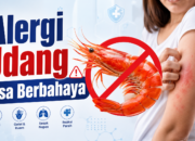 Alergi Udang Bisa Berbahaya, Ini Cara Mencegahnya Kambuh