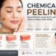 Chemical Peeling untuk Flek Hitam