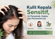 Kulit Kepala Sensitif: Gejala, Penyebab, dan Cara Merawat