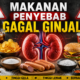 Makanan Penyebab Gagal Ginjal