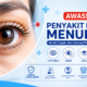 jenis sakit mata menular